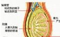 阴囊潮湿